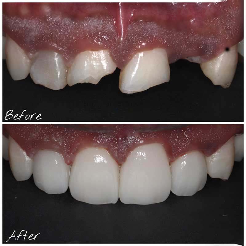 COSMETIC DENTIST in Ghod Dod Rd COSMETIC DENTIST in Ghod Dod Rd