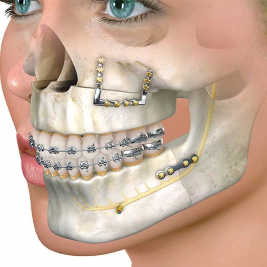 Maxillofacial Surgery in Adityanagar