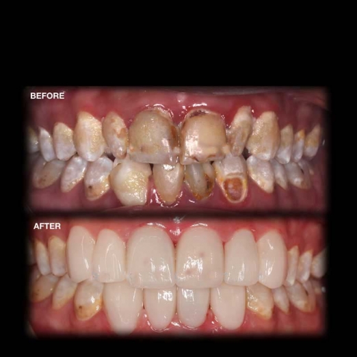 Smile Makeover in Sayedpura